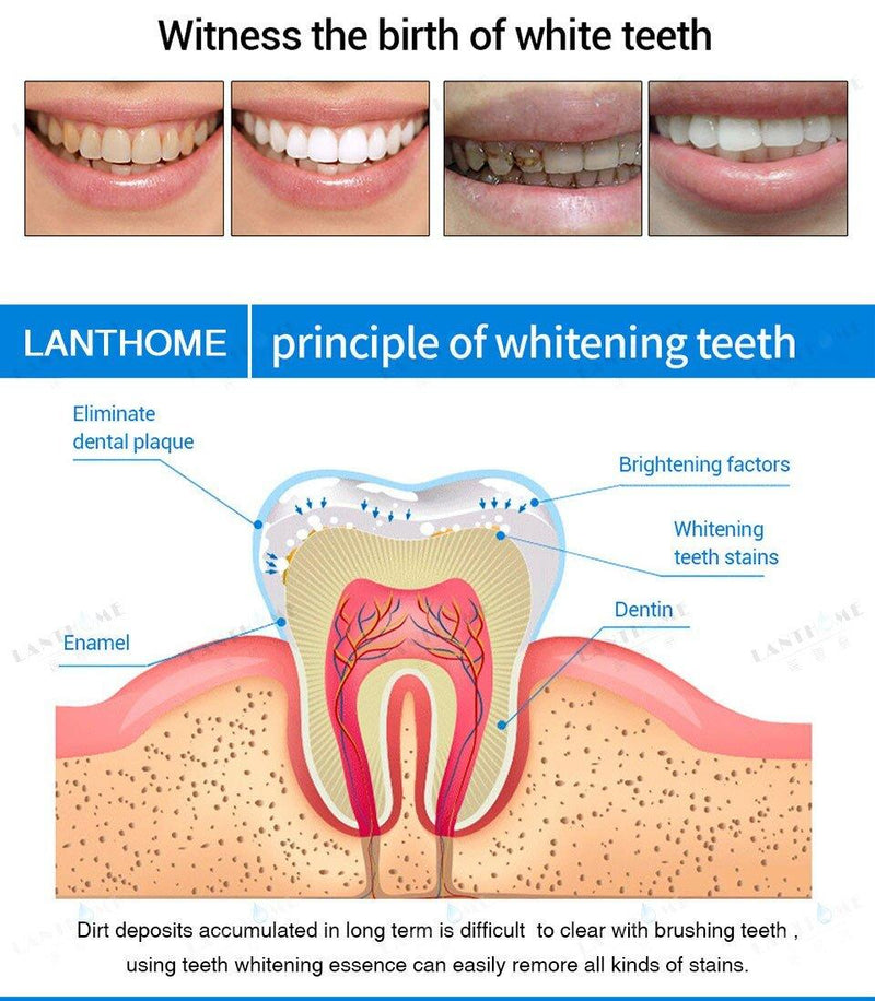 Teeth Whitening Essence - WELLQHOME